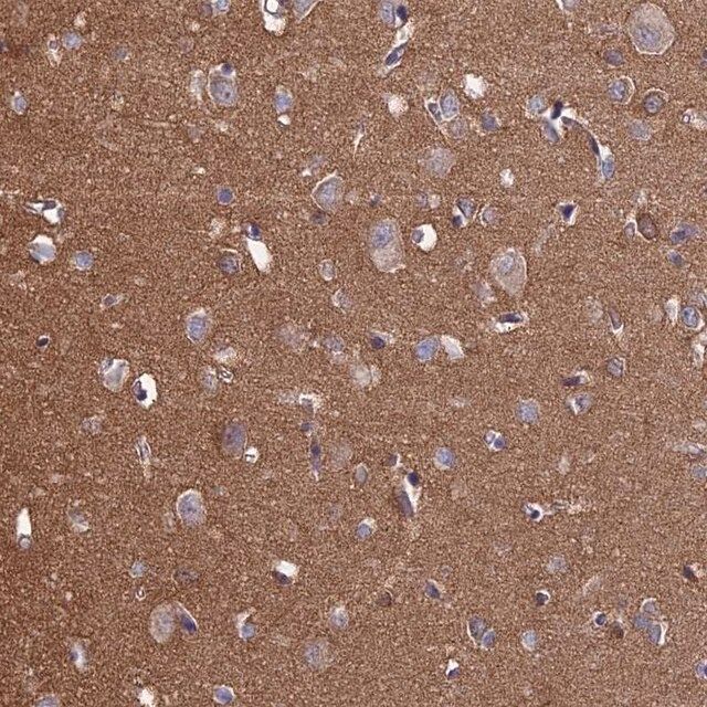 Anti-PCDHA5 antibody produced in rabbit