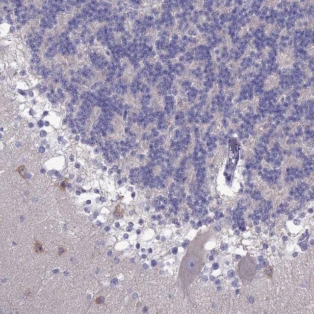 Anti-PCDHA6 antibody produced in rabbit