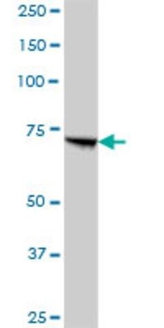 Anti-PCCA antibody produced in mouse