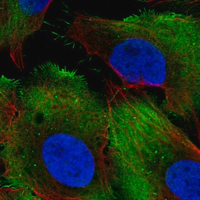 Anti-PCMTD1 antibody produced in rabbit