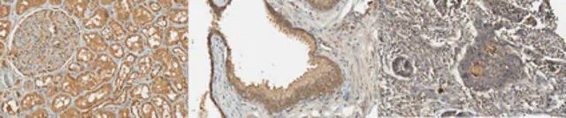 Anti-PCSK9 Antibody, clone 9B3.1