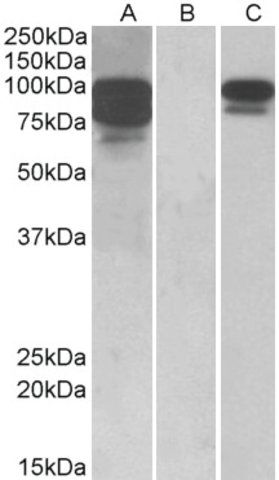 Anti-PCSK9 antibody produced in goat