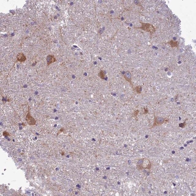 Anti-PCDHB14 antibody produced in rabbit
