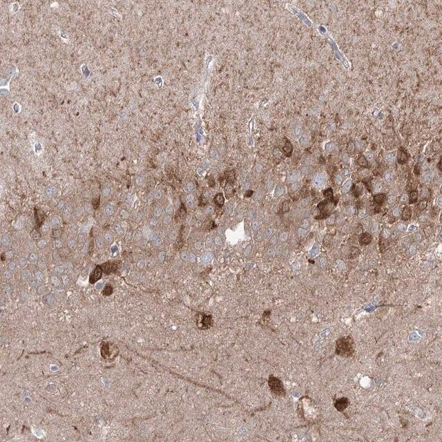 Anti-PCDHA1 antibody produced in rabbit