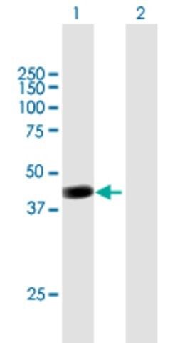 Anti-PCMTD2 antibody produced in mouse