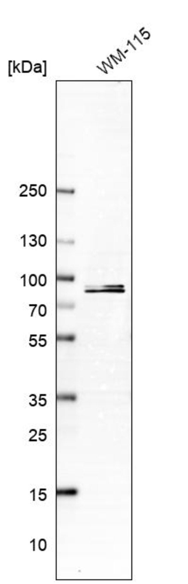 Anti-PCDHB15 antibody produced in rabbit
