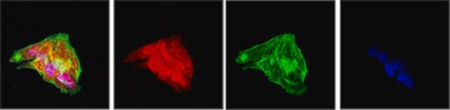 Anti-PCSK9 Antibody