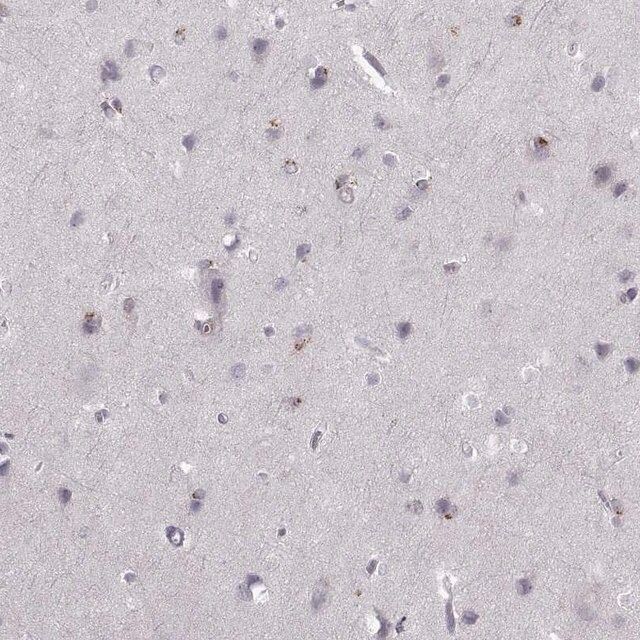 Anti-OPRD1 antibody produced in rabbit