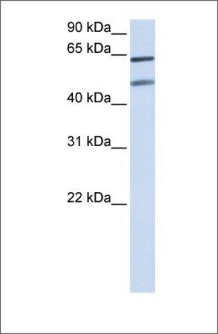 Anti-OPTN (ab2) antibody produced in rabbit