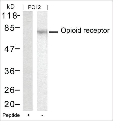 Anti-OPRM1 (Ab-375) antibody produced in rabbit