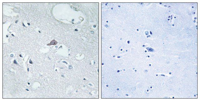 Anti-OPRM1 antibody produced in rabbit