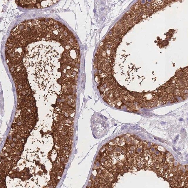 Anti-OR11H1 antibody produced in rabbit
