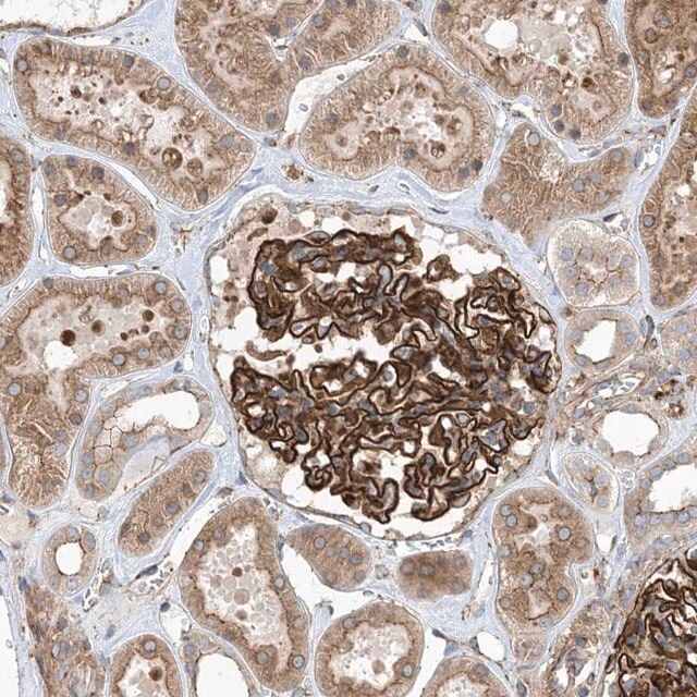 Anti-OTOP1 antibody produced in rabbit
