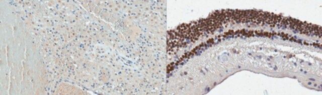 Anti-OTX2 Antibody, clone 8D8.2
