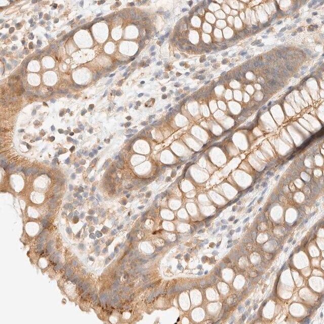 Anti-OTOP2 antibody produced in rabbit