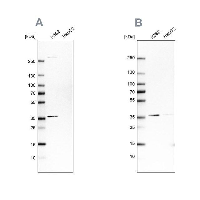 Anti-OTUD6B antibody produced in rabbit