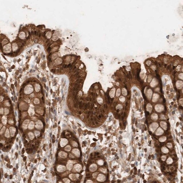 Anti-OTUD7B antibody produced in rabbit