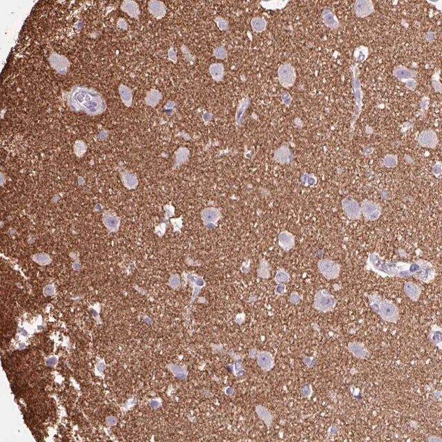 Anti-OTX1 antibody produced in rabbit