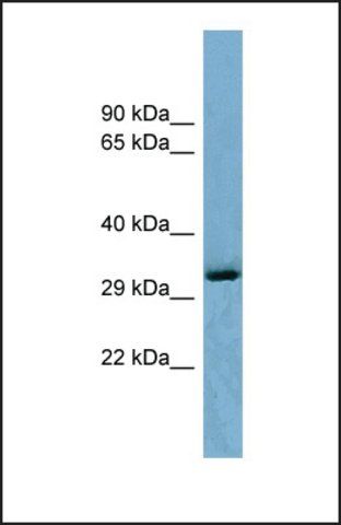 Anti-OTUD6B antibody produced in rabbit