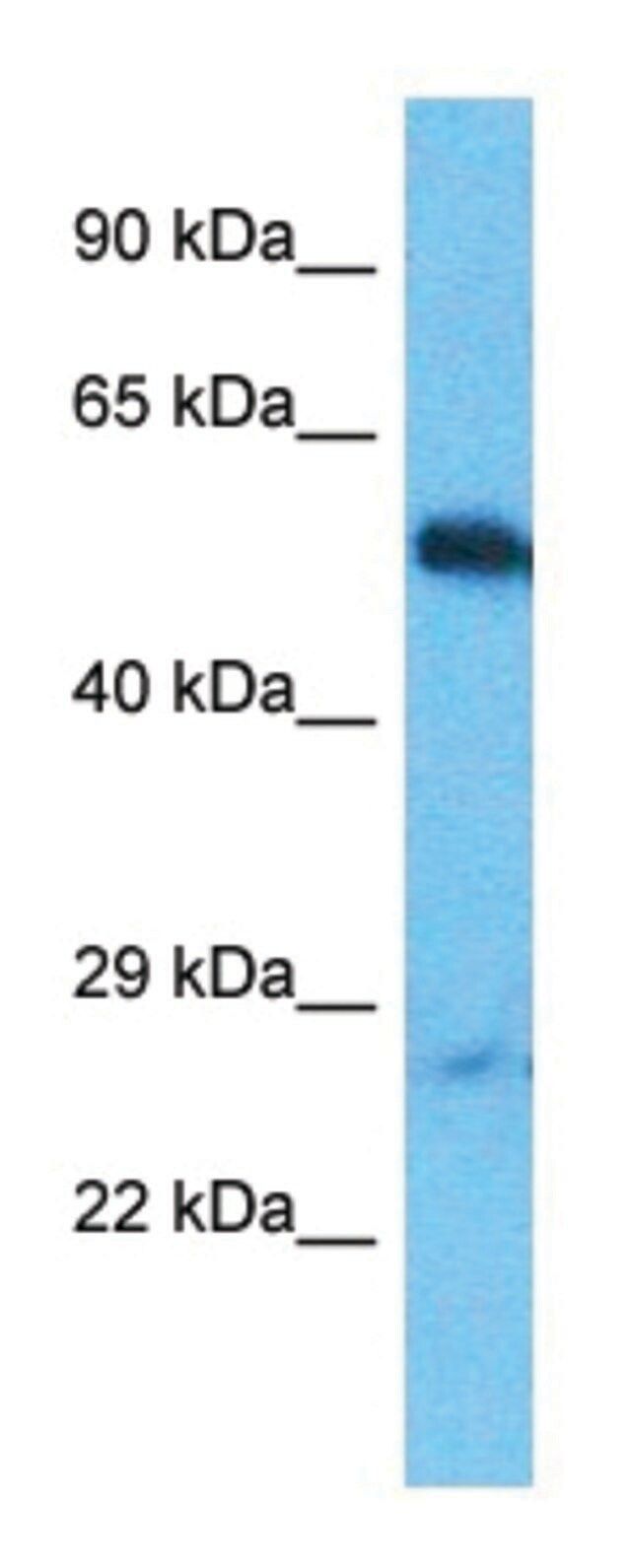 Anti-OTUD1 (C-terminal) antibody produced in rabbit
