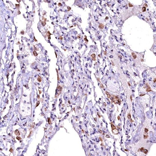 Anti-OVCH1 antibody produced in rabbit