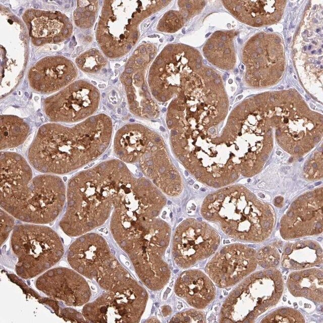 Anti-OTOP2 antibody produced in rabbit