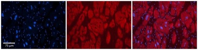 Anti-OTUD7B antibody produced in rabbit