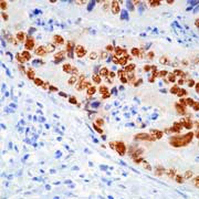 Anti-p53 (Ab-12) (Pantropic) Mouse mAb (DO-7)