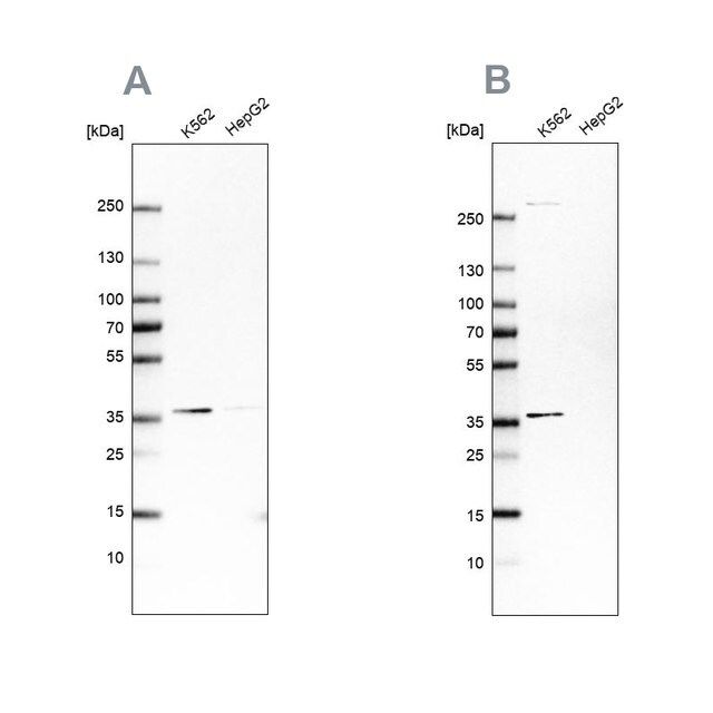 Anti-OTUD6B antibody produced in rabbit