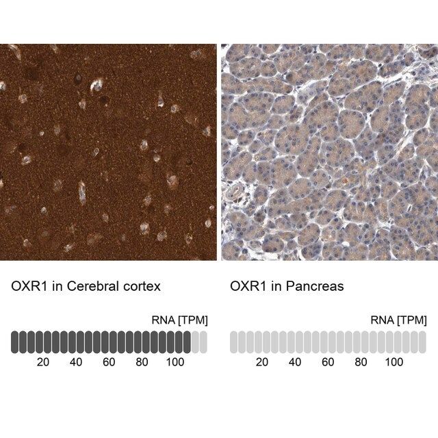 Anti-OXR1 antibody produced in rabbit
