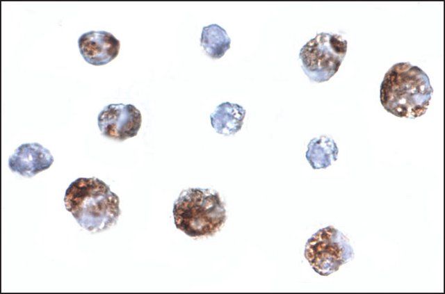 Anti-OTUD4 antibody produced in rabbit