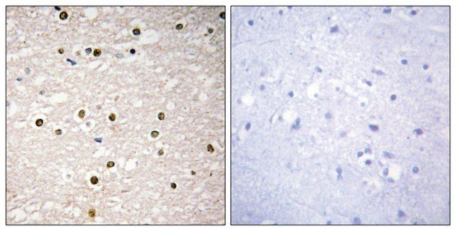 Anti-P73 antibody produced in rabbit