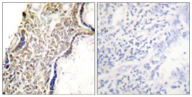 Anti-p14 ARF antibody produced in rabbit
