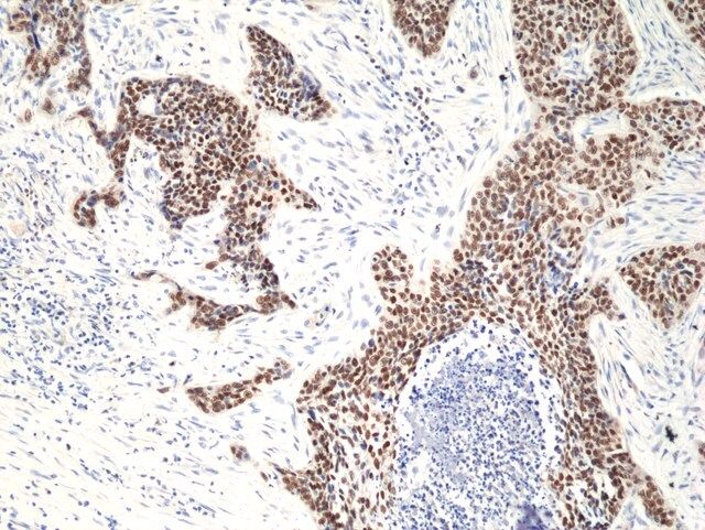 Anti-p40 (deltaNp63) Rabbit Monoclonal Antibody