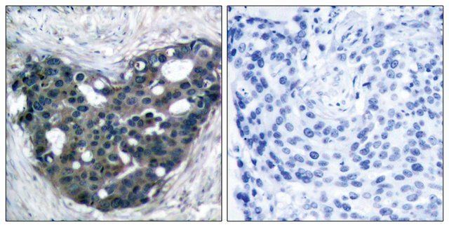 Anti-p56 DOK-3 antibody produced in rabbit