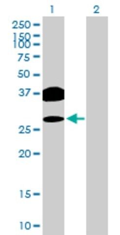 Anti-OVOL2 antibody produced in mouse