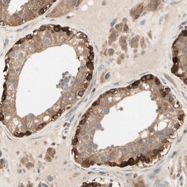 Anti-OXSR1 antibody produced in rabbit