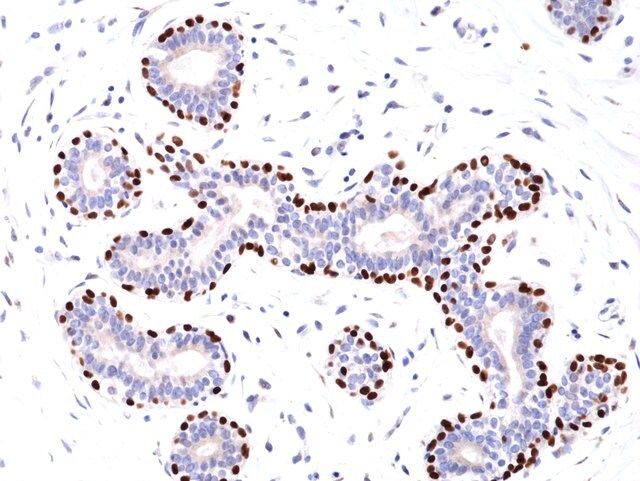Anti-p63 (Tumor Protein 63) Rabbit Monoclonal Antibody