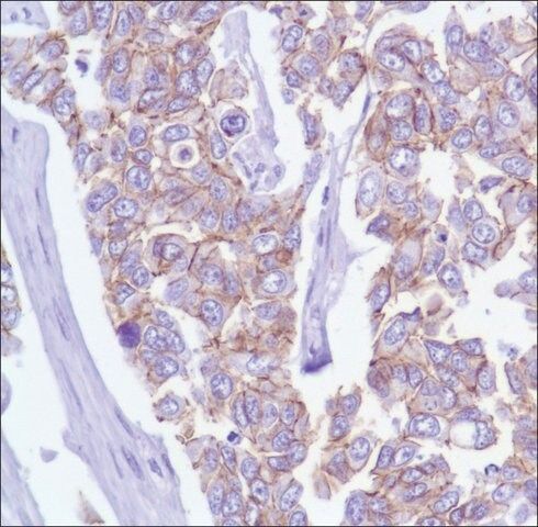Anti-P120 (Catenin delta 1) antibody, Rabbit monoclonal