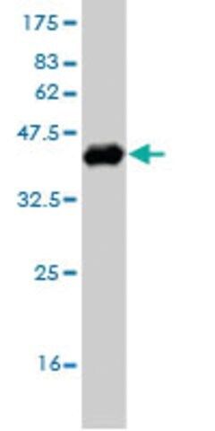 ANTI-OTX1 antibody produced in mouse