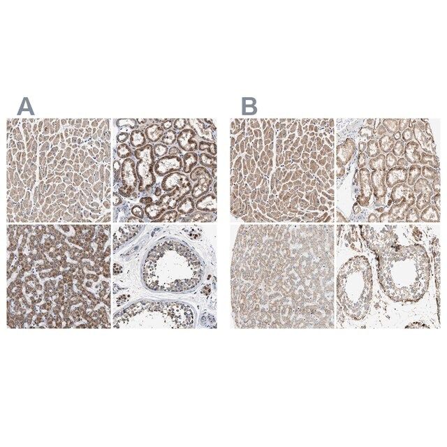 Anti-OXSM antibody produced in rabbit