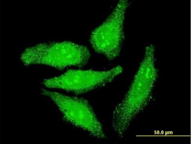 ANTI-OTX1 antibody produced in mouse