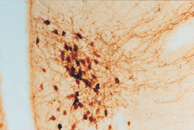 Anti-Oxytocin Antibody