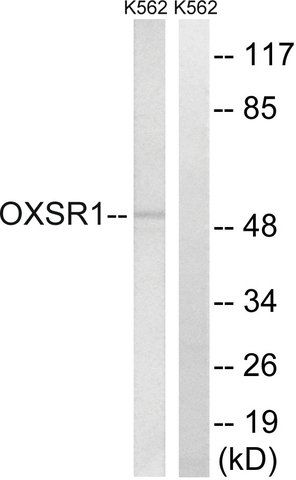 Anti-OXSR1 antibody produced in rabbit