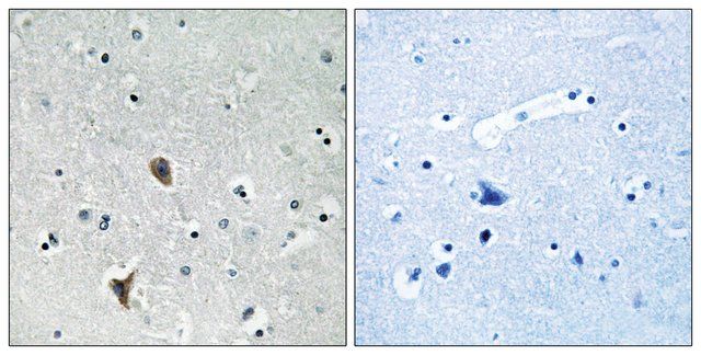 Anti-OXR1 antibody produced in rabbit
