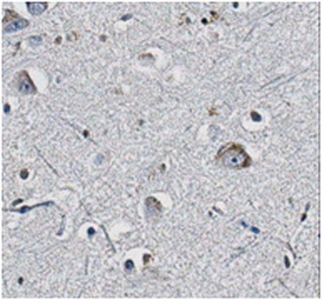 Anti-Pan-QKI Antibody, clone N147/6