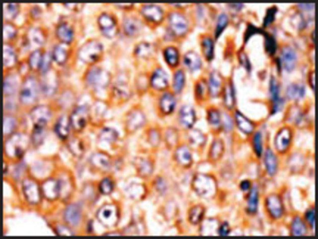 Anti-PANK3 (center) antibody produced in rabbit