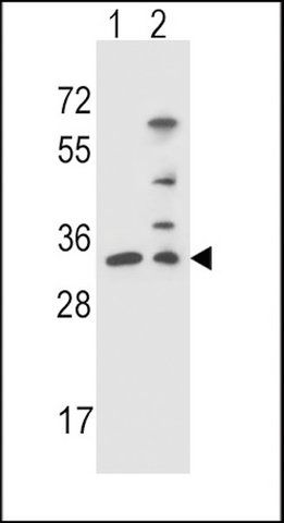 ANTI-NTHL1 (CENTER R103) antibody produced in rabbit