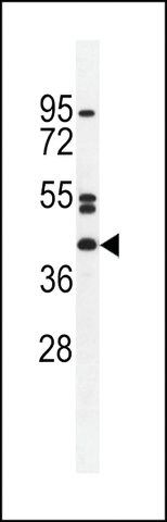 ANTI-NT5DC4 (CENTER) antibody produced in rabbit
