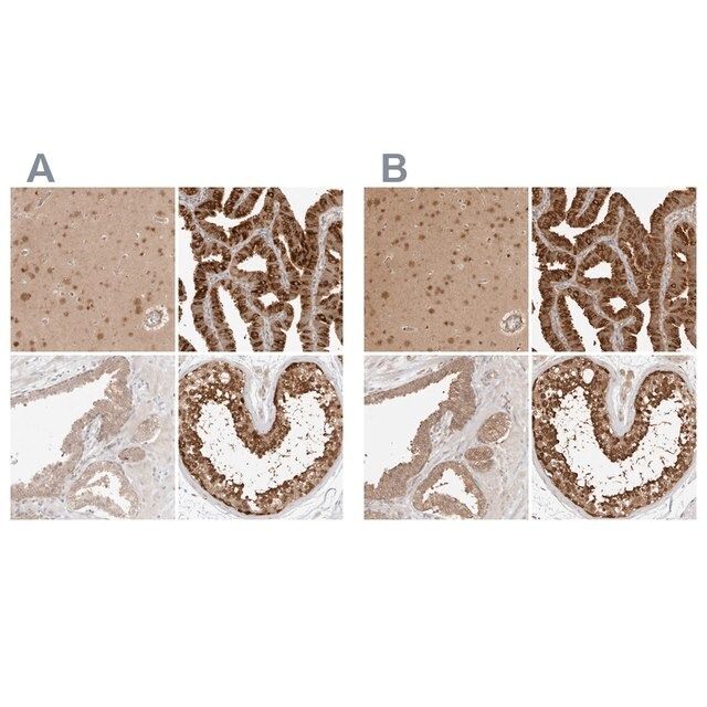 Anti-NUDC antibody produced in rabbit